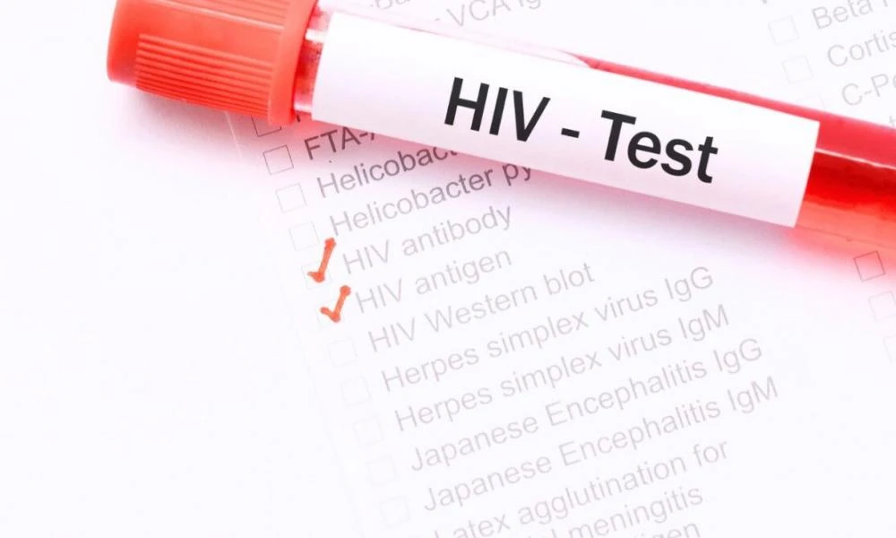 ΕΟΔΥ: 550 νέα περιστατικά HIV λοίμωξης μέσα στο 2024